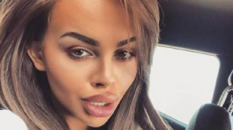 Сузанита призна с колко точно силикон се е наблъскала